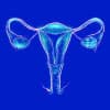 Gynecology